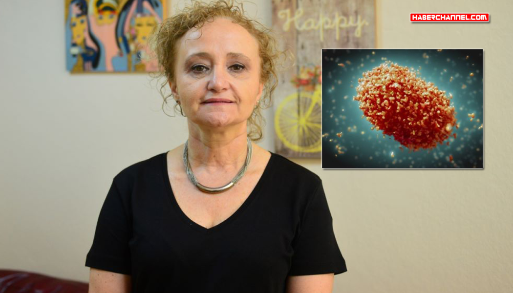 Prof. Dr. Yeşim Taşova: “Maymun çiçeği eski bir hastalık, Covid-19 gibi salgın yapması beklenmiyor” – HABERCHANNEL.COM – Güncel Haberler