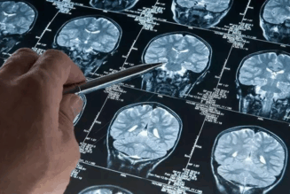 Uyku ilacı, Alzheimer ile ilişkili proteinlerin birikimini azaltabilir… – HABERCHANNEL.COM – Güncel Haberler